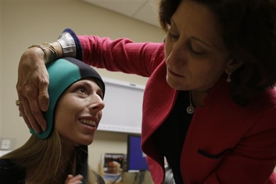 Cold caps tested to prevent hair loss during chemo