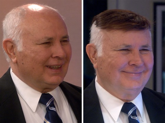 Worst toupee clearance
