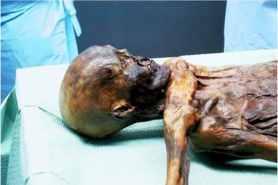 Otzi the Iceman mummy died roughly 5,300 years ago, and since hikers stumbled upon his astonishingly well-preserved frozen body in the Alps in 1991, he as become one of the most-studied ancient human specimens ever.