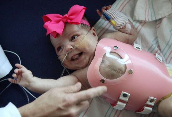 Audrina Cardenas smiles as a steady stream of doctors inspect her plastic heart protective shield a day before she was discharged from Texas Children's Hospital in Houston. Audrina Cardenas, was born with much of her heart outside her body, a highly unusual condition that's usually fatal within the first few days after birth.
