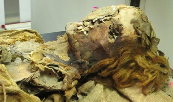 Randall Thompson of Saint Luke's Mid America Heart Institute in Kansas City and colleagues found clear signs of heart disease in a third of 137 mummies they studied from around the world.