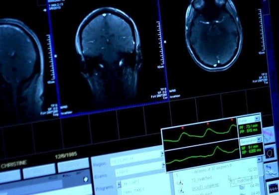 Brain scans at the University of Pennsylvania show which parts of the brain light up when volunteers answer questions about money -- and when they use their imagination.