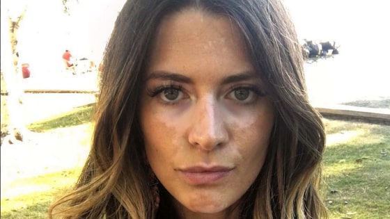 La modelo Breanne Rice tomó la valiente decisión de mostrar su vitíligo ...