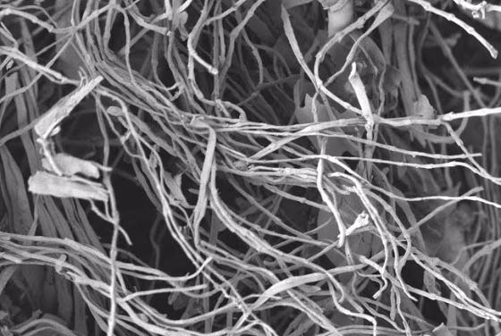 Image: Chicken feather fibers
