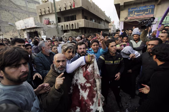 Image: Residents show the media the bloody clothes of a bomb attack victim in Baghdad'
