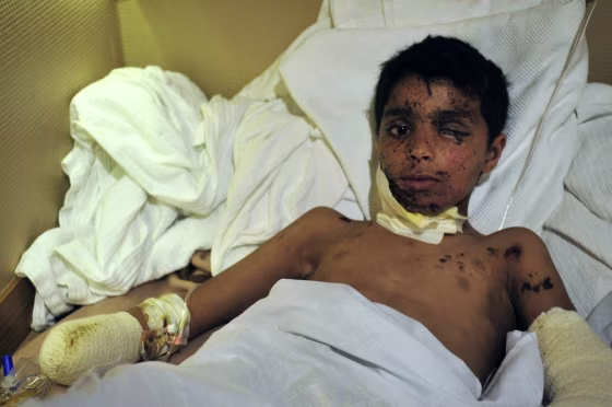 Image: A wounded boy lies in a Turkish ship carrying 250 wounded people from the besieged Libyan city of Misrata.