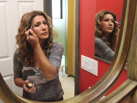 Dinora Rodriguez of Los Angeles experienced a plastic surgery nightmare when her breast implants were&nbsp;merged.