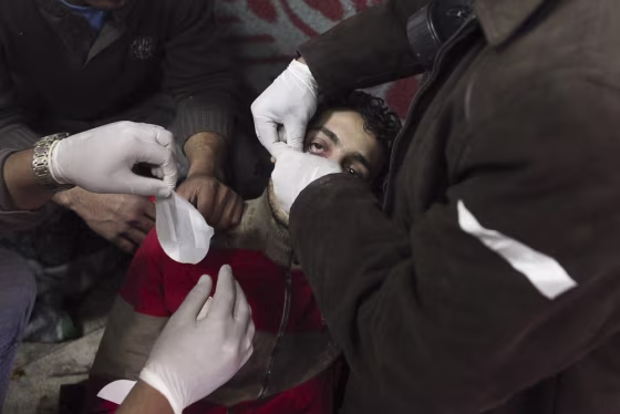 Image: A protester is treated for injuries sustained during clashes with Egyptian riot police