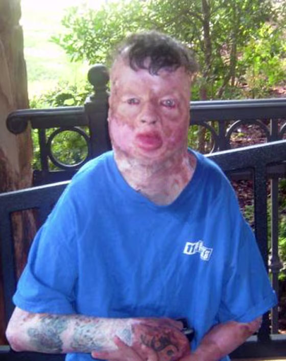 This undated family photo shows Robbie Middleton, who was allegedly doused with gasoline and set on fire on his eighth birthday on June 28, 1998.