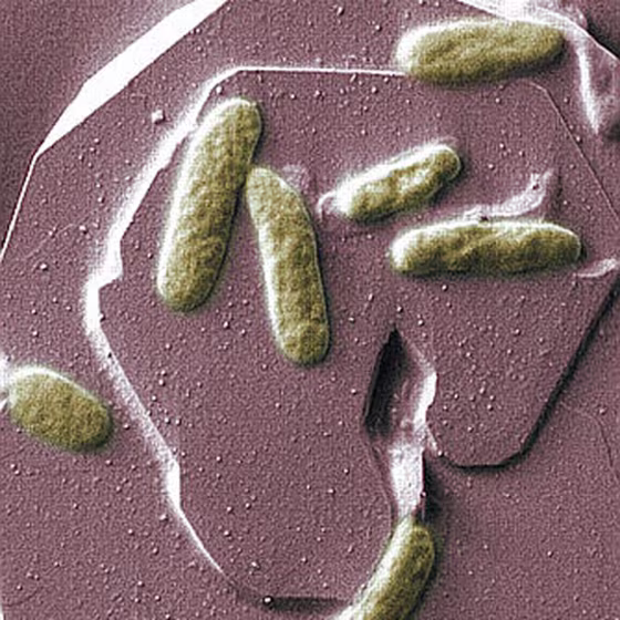 Pacific Northwest National Laboratory |
 
Loves to Eat Uranium
This image shows the bacterium Shewanella oneidensis growing on the surface of the iron oxide mineral hematite. Scientists found that the proteins bacteria like this one use to digest toxic metals are on the outside of the bacteria's cell as well as in an ooze-like material that comes out of the cell.