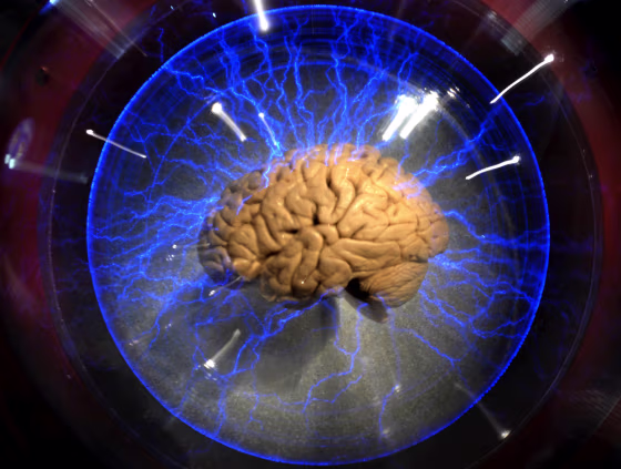Image: Brain