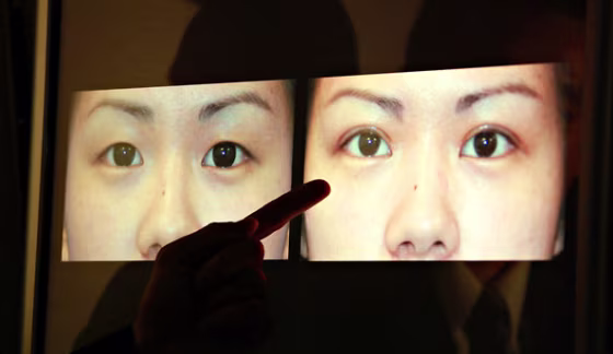 Image: Cosmetic surgery