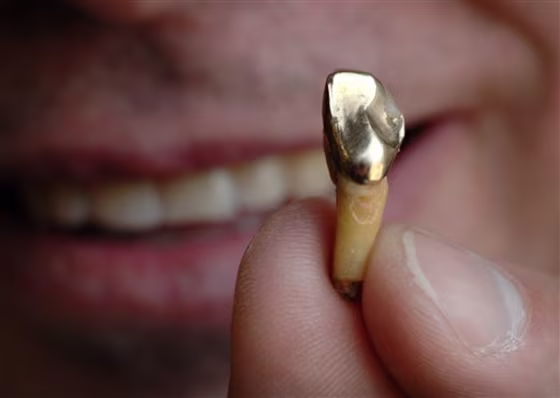 Dental Gold Rush