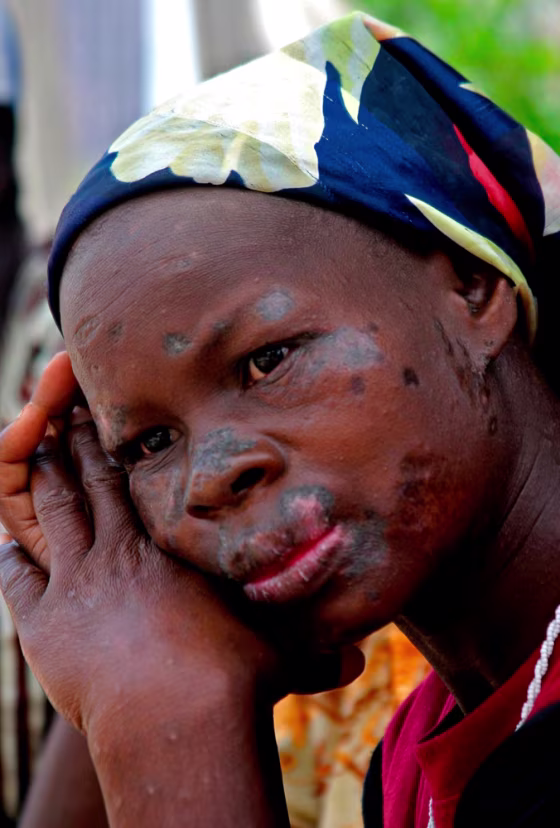 Image: Ivory Coast environmental pollution