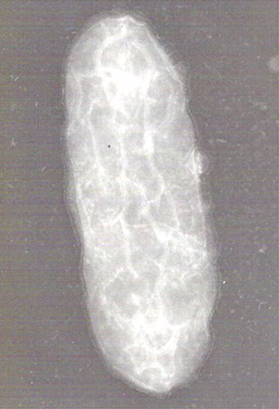 A micrograph shows Geobacter sulfurreducens, a bacterium that can consume uranium and apparently has genes&nbsp;for generating electricity.