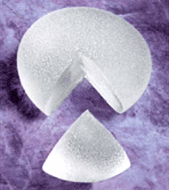 Cohesive silicone gel implants, such as this one made by McGhan, a division of Inamed, are designed to avoid leaks.
