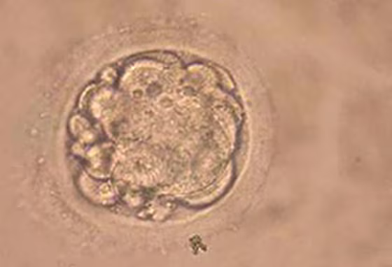 South Korean Researchers Clone Human Embryo