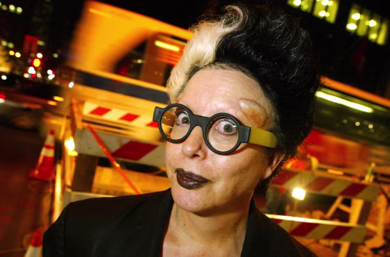 French performance artist Orlan poses April 22 in New York. A bulging saline implant is visible above her left eye. While women in reality shows such as "Extreme Makeover" undergo plastic surgery to improve their looks, Orlan radically transforms herself to challenge traditional perceptions of beauty.