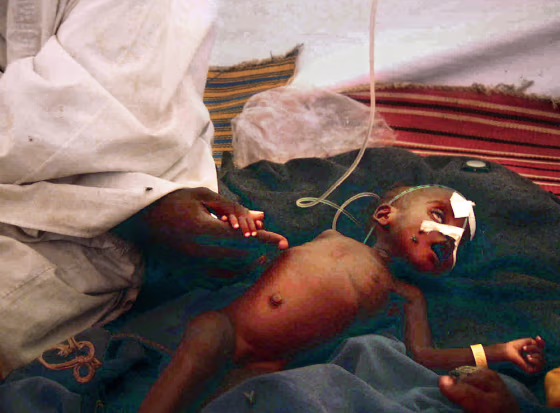 Mohammed Ishaq&nbsp;tries to comfort his dying son, Zohar, at the Mornay refugee camp. Nine-month-old Zohar is dying of lack of food and malaria. His family escaped fighting in Darfur.