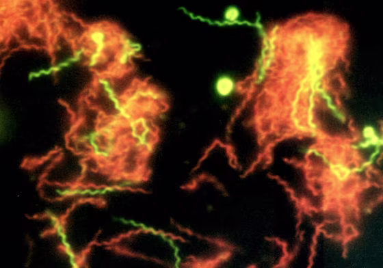 A fluorescent stain renders&nbsp;adds a green tinge to&nbsp;the corkscrew-shaped Spirochaeta americana from California's Mono Lake. Green spots are spheroplasts. Reddish areas are dead cells.