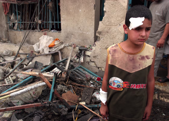 An injured Iraqi boy stands at the site where a suicide car bomber slammed into American&nbsp;troops as they distributed candy to children, killing 26 youngsters and a U.S. soldier, in the Baghdad neighborhood of al-Khalij, on&nbsp;July 13. 