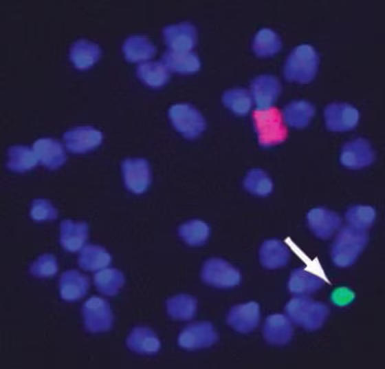 A copy of human chromosome 21 (indicated in green) was added to mouse embryonic stem cells, yielding mice with symptoms of Down syndrome.
