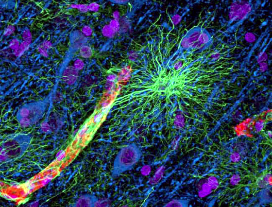 A false-color view of human brain tissue shows an astrocyte (green) reaching out to a blood vessel (yellow and red). The neurons (blue) are not in direct contact with the vessel and rely on astrocytes for the transport of nutrients of waste.