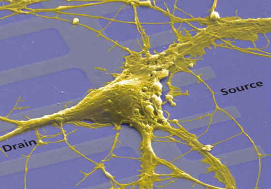 A neuron from a rat brain sprawls over a linear array of transistors. The cell's ionic current interacts with the electronic current in the silicon.