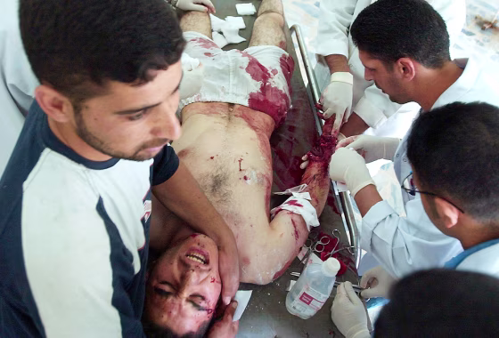 A man injured in a drive-by shooting is treated at a hospital on Wednesday in Khalis, north of Baghdad. 