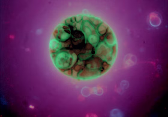 This photo, provided by ProtoLife, shows vesicles, artificial membranes for cells, made from scratch. Teams around the world, including ProtoLife, are trying to create synthetic life in a lab.