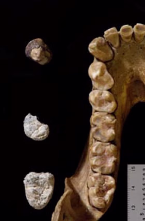 Fossil teeth from the newly named ape species, Chororapithecus abyssinicus, are shown alongside a female gorilla tooth line. Scientists say the fossils are 10 million years old.