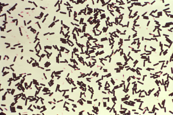 C. perfringens
