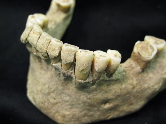 Image: Millennium-old teeth
