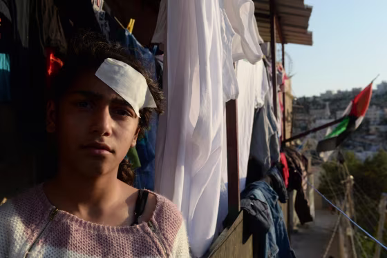Fatimah Kayed Al-Rajabi, 13 years old, daughter of Abeer Al-Rajabi, was shot by rubber bullet in the head 3 days ago while sitting on the balcony in her house in Silwan.