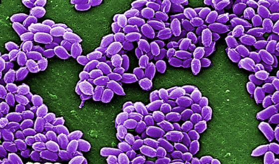 Spores from the Sterne strain of anthrax bacteria (Bacillus anthracis) are pictured in this handout scanning electron micrograph (SEM) obtained by Reuters May 28, 2015. The U.S. military mistakenly sent live anthrax bacteria to laboratories in nine U.S. states and a U.S. air base in South Korea, after apparently failing to properly inactivate the bacteria last year, U.S. officials said on May 27, 2015.