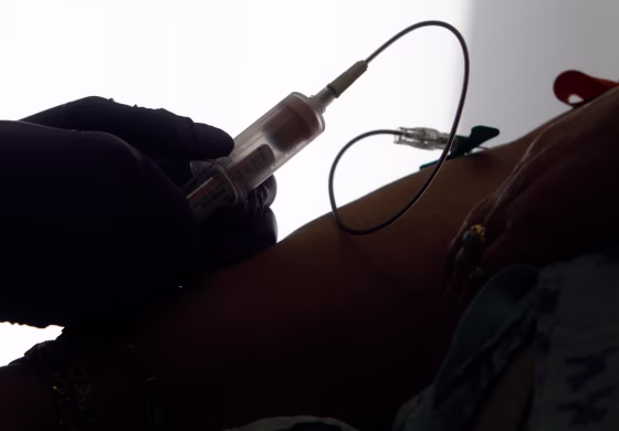 Image: liquid biopsy