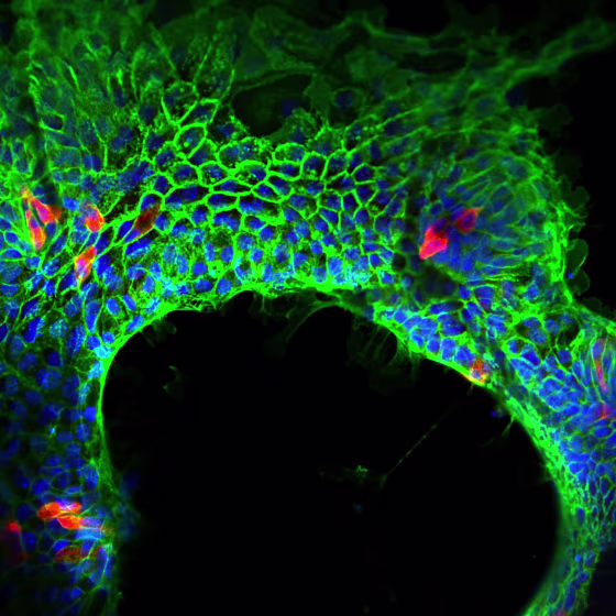 “Lab-made intestine: Johns Hopkins and University of Pittsburgh researches laced material used in surgical sutures with gut stem cells, immune and connective tissue cells. The work brings efforts a step closer to developing a fully implantable intestine as gut replacement therapy.” Photo credit: University of Pittsburgh Medical Center
