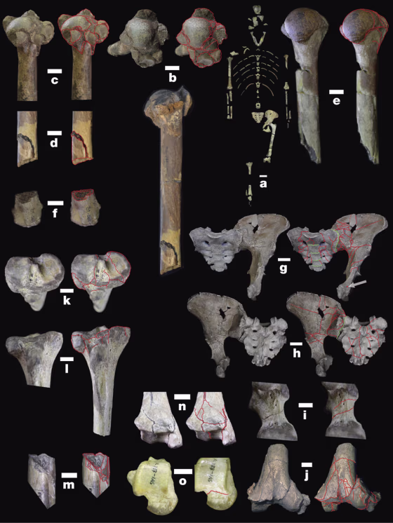 a, Lucy. b, c, Right humerus (b, top: stereo, superior, medial up; bottom: lateral; c, stereo, posterior) preserves valgus head-shattering four-part proximal fracture.