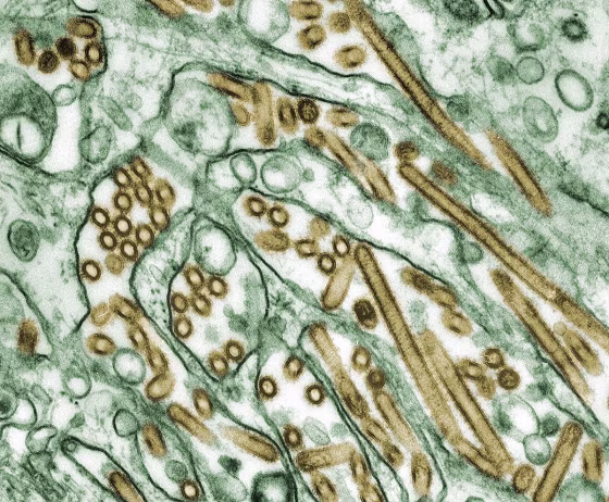 A new study explains why children and young adults are more likely to be infected with H5N1, shown here, while H7N9 disproportionately affects older adults.