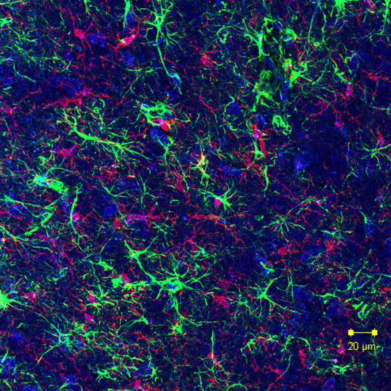 Gut microbes can initiate activation of microglia (brain-resident immune cells), which leads to the neuroinflammation that is characteristic of Parkinson's disease.