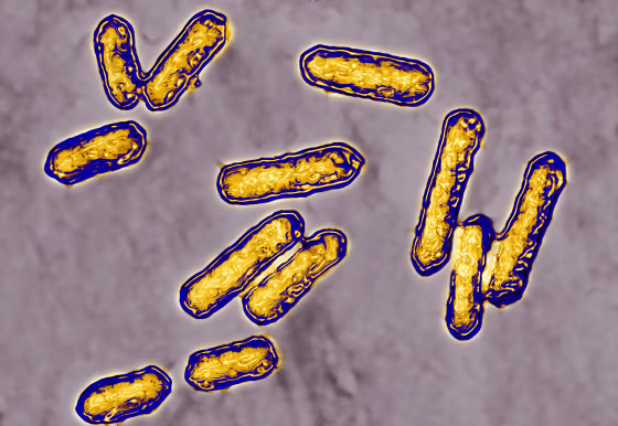 Image: Listeria