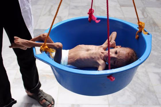 Image: TOPSHOT-YEMEN-CONFLICT