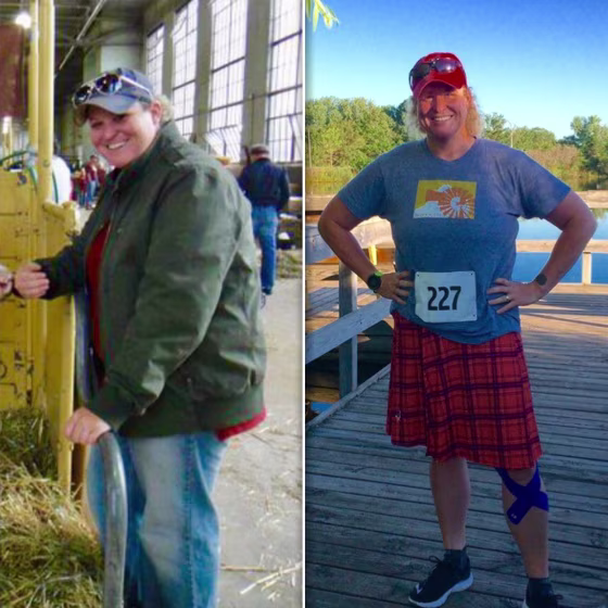 Karla Pankow before and after her 100 pound weight loss.