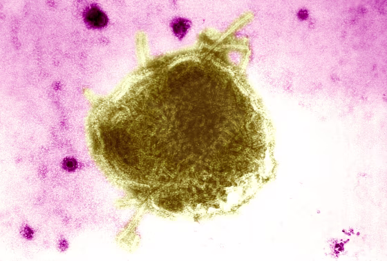 Paramyxoviridae Virus