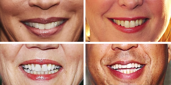 Photo of illustration of smiling candidates.