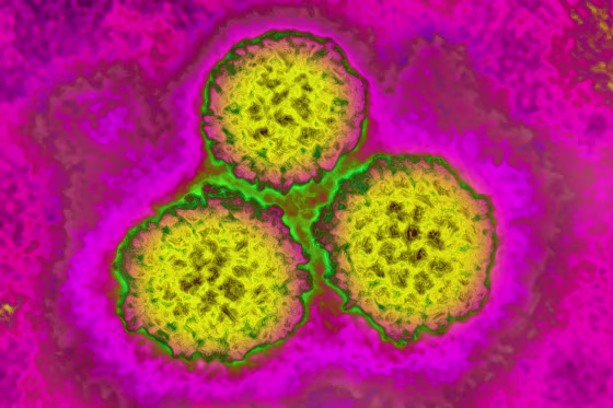 Image: A strain of HPV taken with a transmission electron microsope.