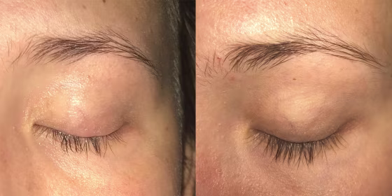 The before and after photos are pretty impressive.