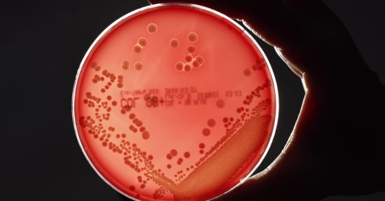 Image: MRSA bacteria are seen in a petri dish in a microbiological laboratory in Berlin