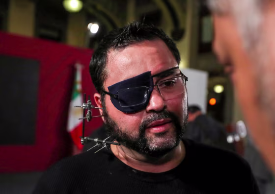 Image: Paul Velazquez, a video blogger wearing an eye patch and with metal surgical pins in his face, listens to Mexican President Andres Manuel Lopez Obrador at a news conference in Mexico City on Feb. 5, 2020.