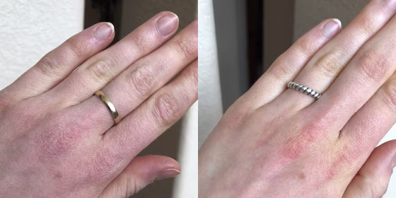 The O'Keefe's Working Hands hand cream recommended by Dr. Wattenberg helps to heal dry skin. "I keep mine by the sink so I don't forget to use it after washing my hands," said TODAY Associate Editor Megan Foster.